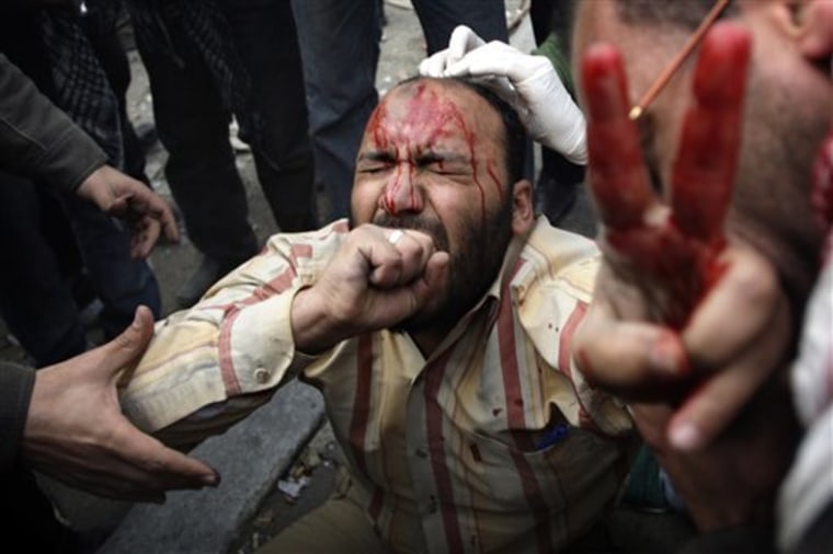 A wounded anti-government protestor is tended during clashes in Cairo, Egypt, on Thursday. 